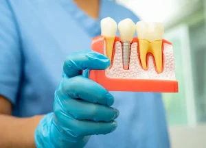 Dental Care